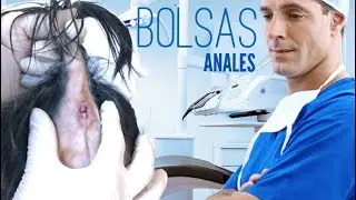 Limpieza de bolsas anales en perros