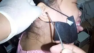 Removing Hard Earwax , No Problem! (Ear Irrigation & Ear Flushing)