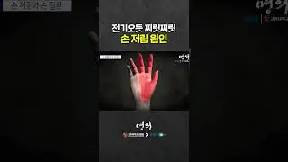 손이 저리는 3가지 원인