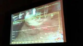 GDC 2011 - Halo Reach Network Bandwidth Profiler