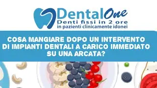 Cosa mangiare dopo l’intervento di impianti dentali a carico immediato - Dottor Vittorio Magnano