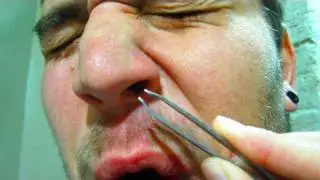 Biggest BOOGER Ever! (11.04.09 - Day 188)