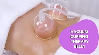 MOMMY TUMMY FIX- VACUUM CUPPING THERAPY BELLY TUMMY PART 3 | myChway MS2183