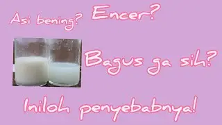 My breast milk is runny is it good?  | causes of thin and thick breast milk | Fore milk hind milk
