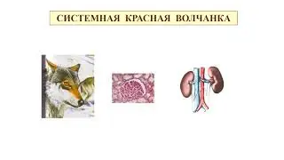 Болезни соединительной ткани