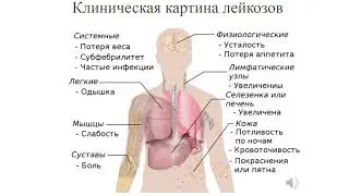 4 курс СФ. Лекция на тему: "Заболевания крови. Гемобластозы".