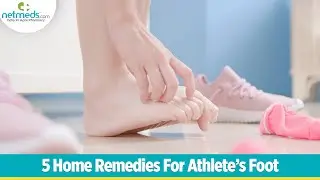Athlete's Foot: 5 Amazing Home Remedies For This Fungal Infection