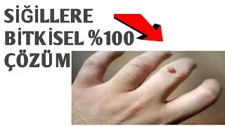 Hastalıklardan %100 doğal bitkilerle nasıl kurtuluruz?