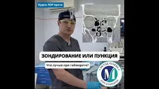 Лечение гайморита без пункции