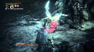 Bloodborne™ Orphan of Kos