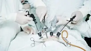 Uniportal VATS Right Basal Segmentectomy with Indocyanine Green Imaging