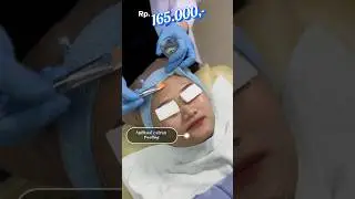 Layanan Peeling Treatment di RSUD Bali Mandara