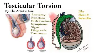 Testicular Torsion | Anatomy Function | Risk Factors Causes Symptoms Diagnosis Treatment