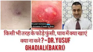 Do's & Don't's for boils, pimples, wounds any type of ulcer.phode hone par kya khaaye kya naa karein