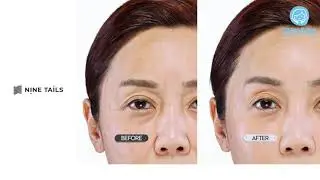Nine Tails - Advanced Line Lift Serum (user 2) | HaruTube