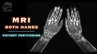 MRI – BOTH HANDS – PATIENT POSITIONING