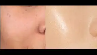 How to Get Crystal Clear Glowing Skin, Spotless Skin Tone | DeTan, Pimple Clean - SuperWowStyle