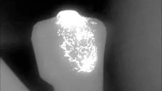 Which walkthrough (Head)