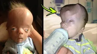 10 Most UNUSUAL Babies In The World