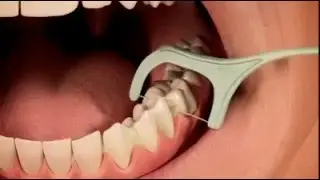 Чистка зубов