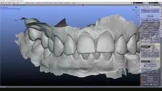 Blenderfordental - 3D print models for beginners