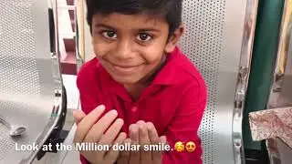 Cosmetic Hand Restoration On  a 7 Year Old Boy, His Reaction is Priceless !