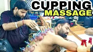 ASMR Cupping massage therapy | Head massage | Cup back massage | Pain Relief | Shamboo Barber