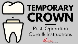 What To Do After Getting a Temporary Crown | #experienceHFD