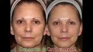 Медутокс Отзывы