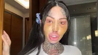 Surgery-addicted social media star wars