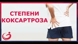 Степени коксартроза