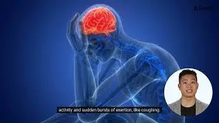 What Is An Exertional Headache?