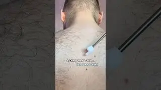 У НЕГО ПРЫЩИ НА СПИНЕ 