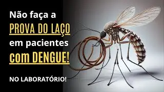prova do laço em pacientes com dengue NÃO DEVE SER FEITA!