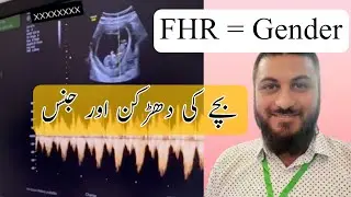 Fetal Heart rate gender | FHR baby boy or girl | bachy ki Dil ki dahrkm
