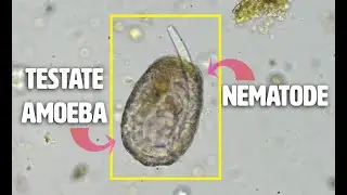 Soil Food Web CYCLING: a Nematode vs Giant Testate Amoeba!! Never Before Seen Footage!!
