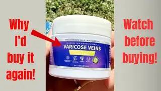 Honest Review and Demo - Yongsenina Varicose Veins Cream