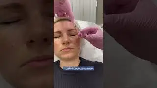 БОТОКС - противопоказания 
