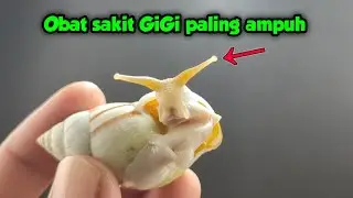 Cukup di TETES saja, hitungan detik sakit GiGi langsung sembuh !