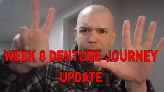 Week 8 Denture VLOG Update (2nd Reline)