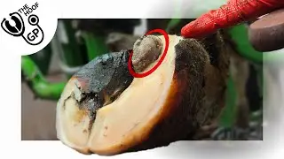 Huge Ulcer!