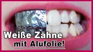 ▶︎ Zähne aufhellen mit Alufolie - es funktioniert!