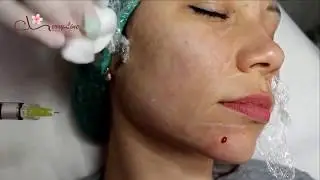 Skin care for all of ladies