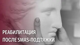 Реабилитация после СМАС-подтяжки