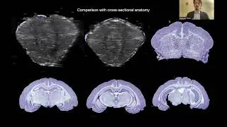Edoardo Porto: 3-D Ultra-High-Frequency Ultrasound Atlas of Isolated Guinea Pig Brain Preparation