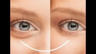 How we do Remove Eye Circles | Short Tip | NGS Art