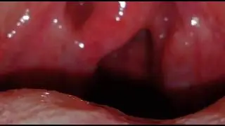 My uvula | Touching my uvula | VORE UVULA VIDEO