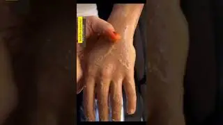 Viral SunTan Remove Pack Homemade/Get Fair Hand In 10 Mnts ll #skincare #viralvedio #ytshorts#shorts