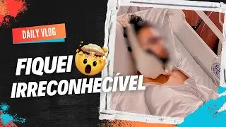 DALY VLOG DIA DA CIRURGIA ORTOGNÁTICA