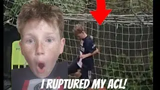 I ruptured my ACL full video!!!!!!!